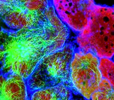 Obrazowanie komórki HCS