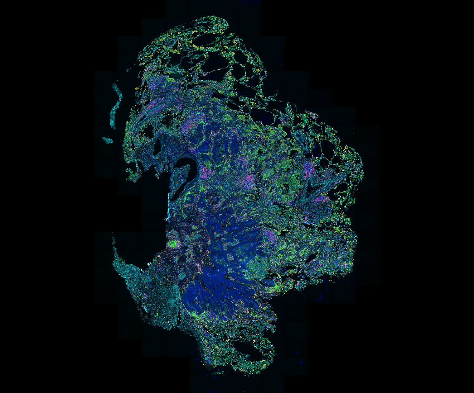 Wieloparametrowa histochemia kontekstowa
